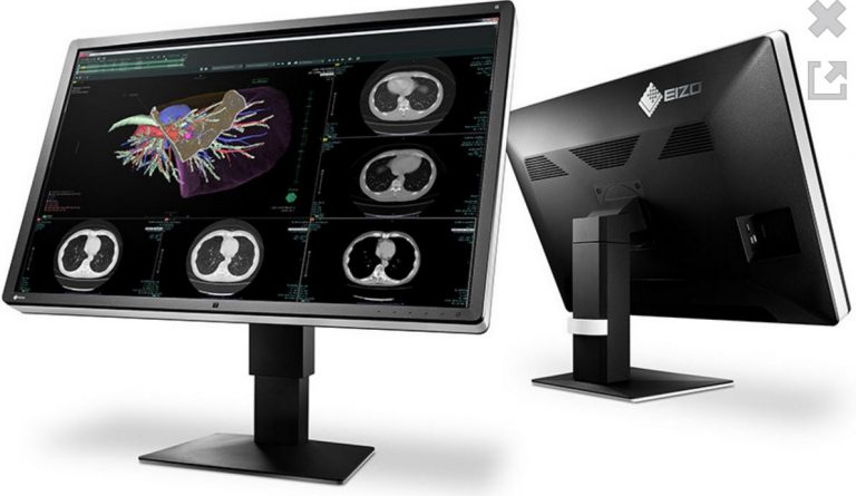 EIZO เปิดตัวมอนิเตอร์รุ่น  RadiForce RX660