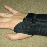 splint