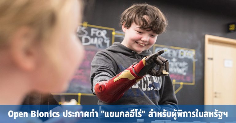 Open Bionics ประกาศทำ “แขนกลฮีโร่” สำหรับผู้พิการในสหรัฐฯ ราคาเริ่มต้นที่ 3,000 ดอลลาร์ !!