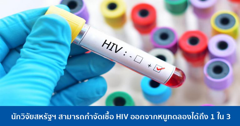 นักวิจัยสหรัฐฯ สามารถกำจัดเชื้อ HIV ออกจากหนูทดลองได้ถึง 1 ใน 3