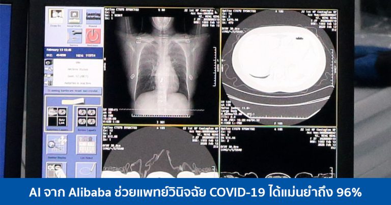 AI จาก Alibaba ช่วยแพทย์วินิจฉัย COVID-19 ได้แม่นยำถึง 96%