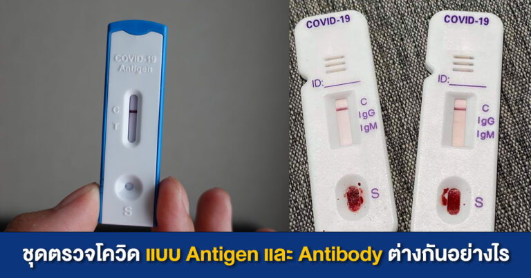 ชุดตรวจโควิดด้วยตนเอง แบบ Antigen และ Antibody ต่างกันอย่างไร